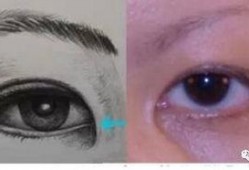 各类网红双眼皮,多样美眸的时尚演变解析